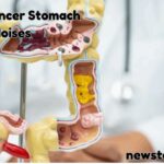 Bowel Cancer Stomach Noises