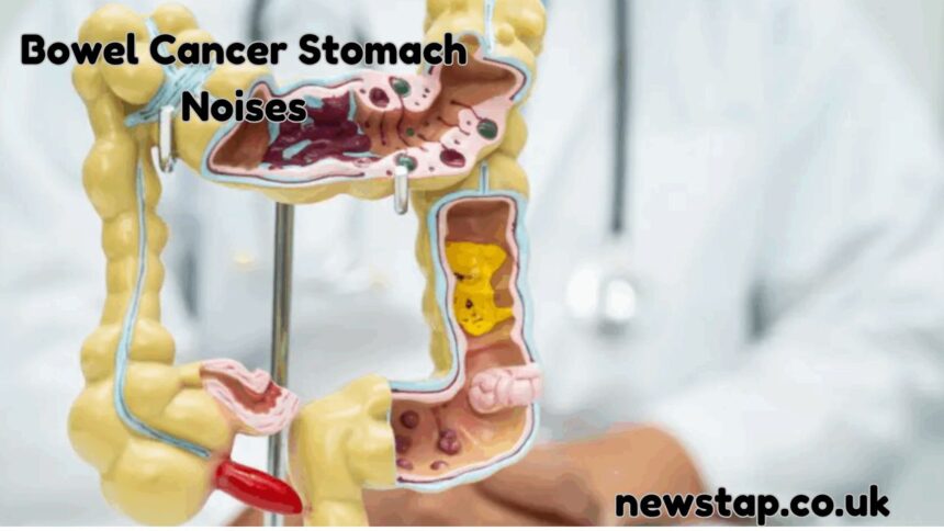 Bowel Cancer Stomach Noises