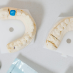 Cosmetic Bonding in London