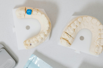 Cosmetic Bonding in London