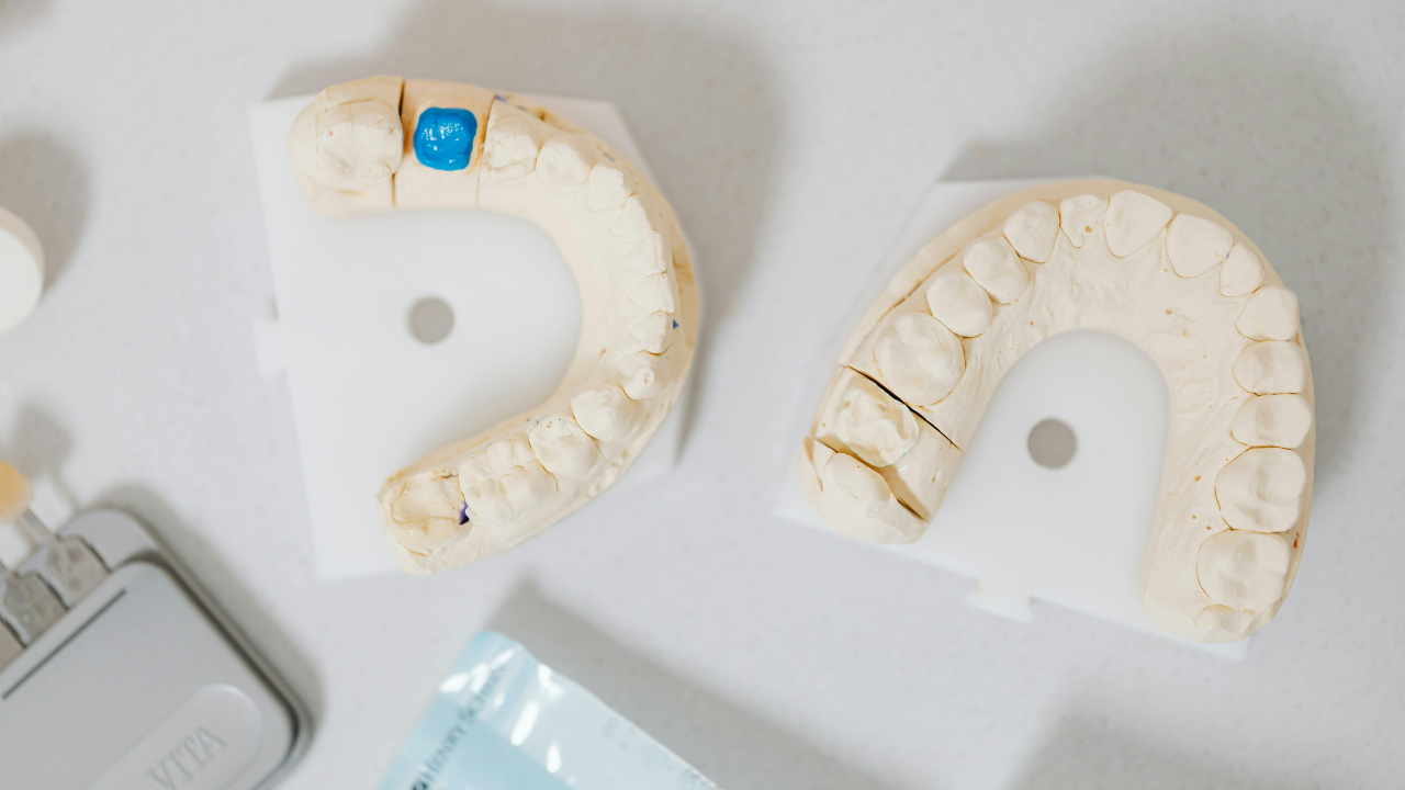 Cosmetic Bonding in London